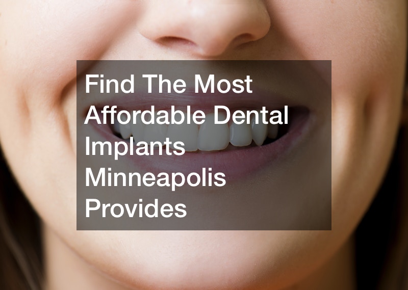 Find The Most Affordable Dental Implants Minneapolis Provides Dental Hygiene Association