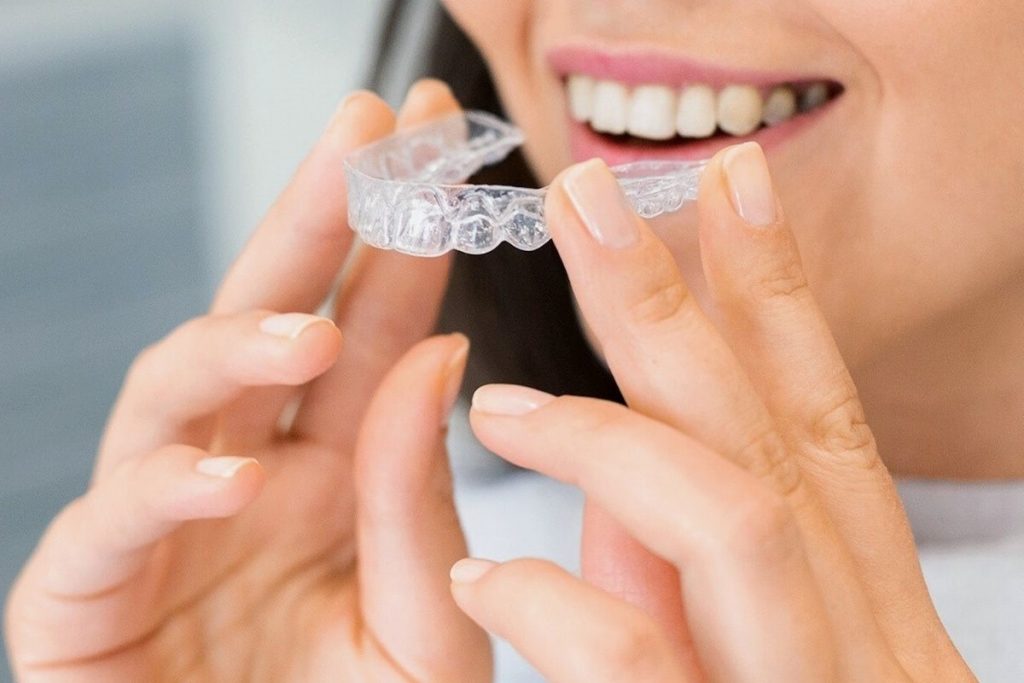 invisalign