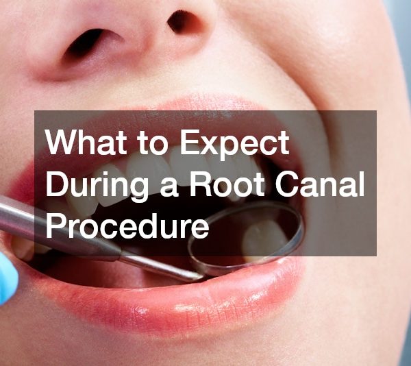 What to Expect During a Root Canal Procedure